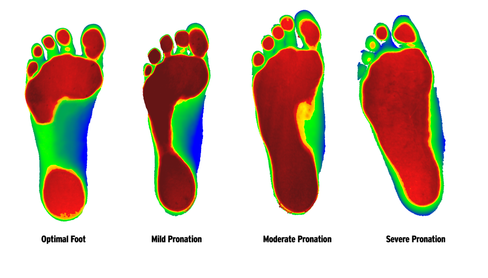 foottypes_-_footlevelers